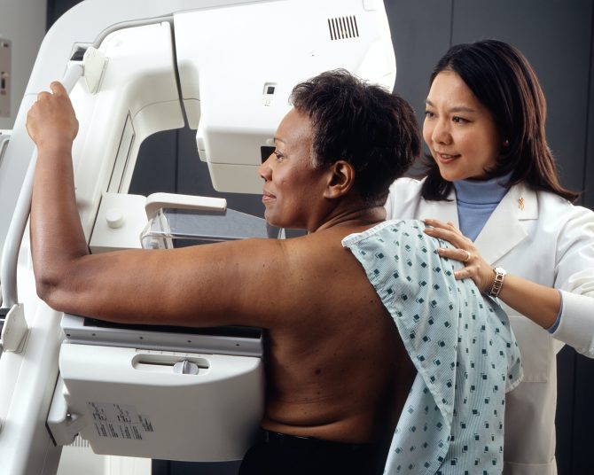 How To Get A Mammogram in France (for Free)
